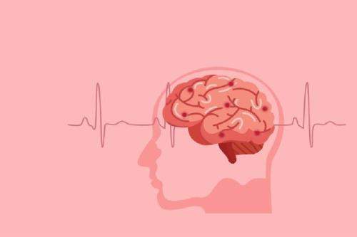 روشی برای ذهن خوانی بیماران گرفتار صدمه های مغزی