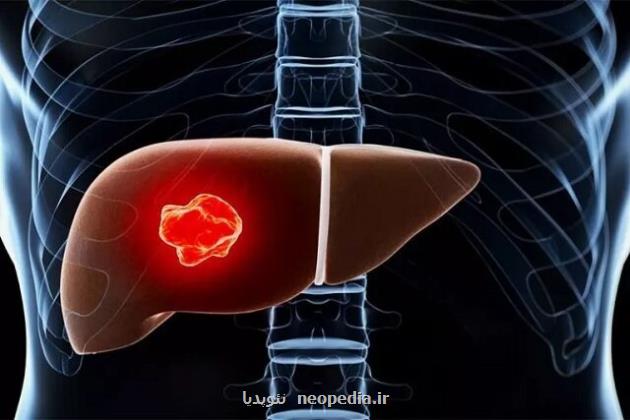 مسیرهای پیامرسان مشترک در تکوین کبد و سلول های سرطانی کبد