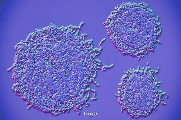 پاشنه آشیل سرطان تخمدان هدف یک ترفند نانویی قرار گرفت