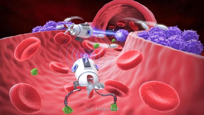 یک بمب افکن تومورهای سرطانی را هدف می گیرد