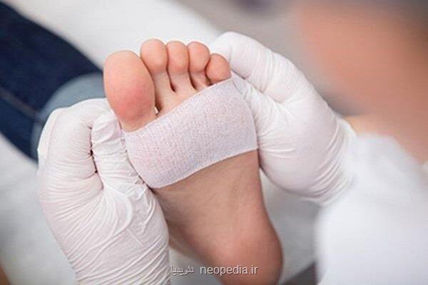 تولید زخم پوش های دولایه از پیله ابریشم و جلبک برای کاهش خطر عفونت