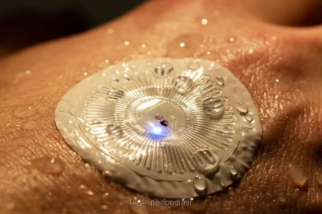 تشخیص آلزایمر و پارکینسون از عرق بدن ممکن می شود!