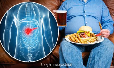 اضافه وزن مردان تهدیدی برای مبتلا شدن به سرطان پانكراس
