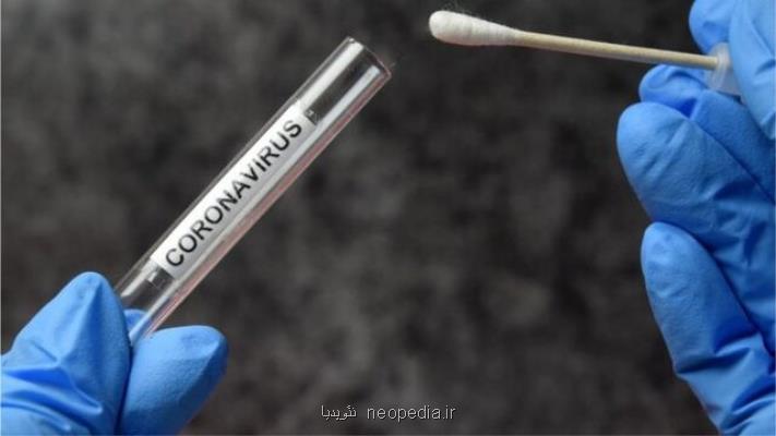 تست PCR قابل اعتمادتر است یا نتیجه سی تی اسكن؟