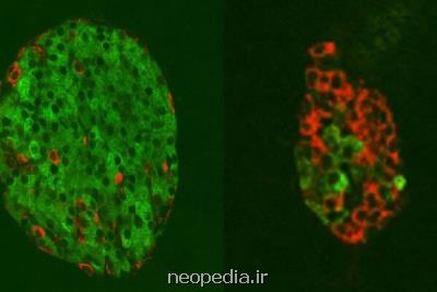 روش جدید احیای سلولی برای درمان دیابت